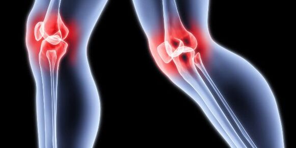 Osteoartrite do xeonllo