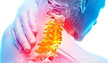 Signos dunha osteocondrose da columna cervical